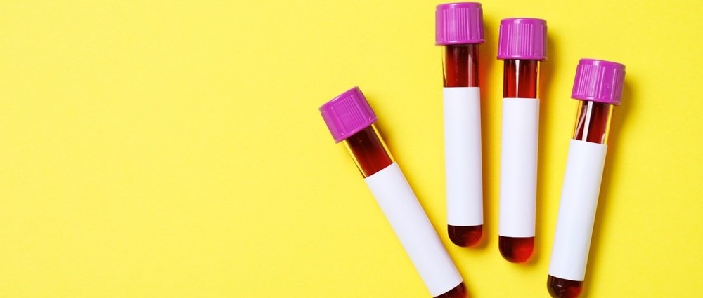 Preparar para Exame de Sangue: Guia Essencial