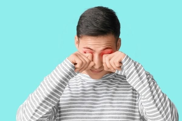 Aliviar Coceira nos Olhos no Verão: Guia Definitivo