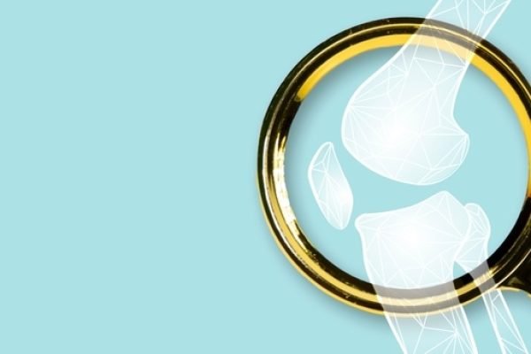 Obesidade Saúde Articular: Guia Completo 2025