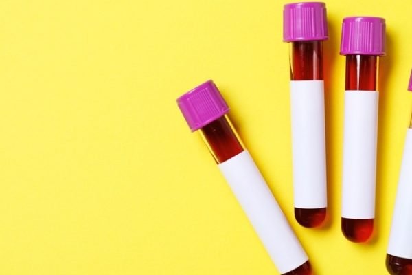 Preparar para Exame de Sangue: Guia Essencial